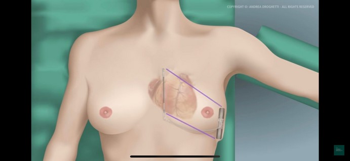 La imagen tiene un atributo ALT vacío; su nombre de archivo es Boston-1.jpeg